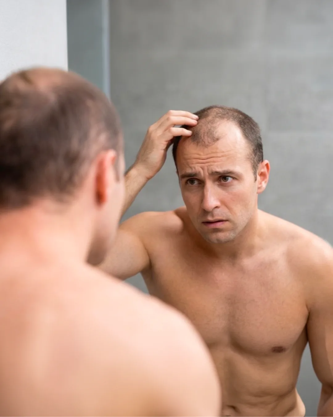 Uomo allo specchio che osserva il diradamento dei capelli